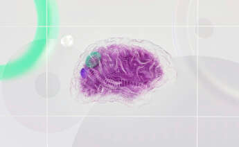 cerebro morado